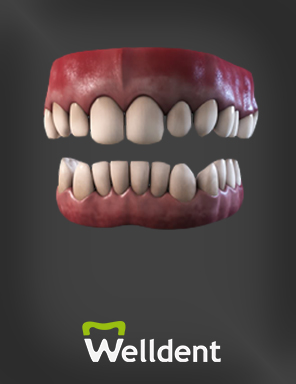 dentistas baratos en costa rica
